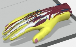 CREAFORM HandySCAN 形創(chuàng)手持式三維激光掃描儀在醫(yī)療器械行業(yè)的應用